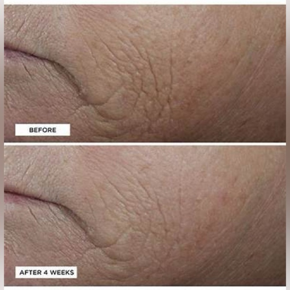 Perricone MD Neuropeptide Smoothing Facial Conformer-anti-aging, brighten, Vegan - Picture 4 of 5